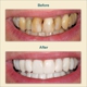 Palos Hills Dental, Anthony J. Tisoncik, DDS