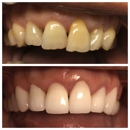 NÜVA Smile - Dentists