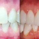 Bridgeline Dental - Implant Dentistry