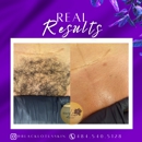 Black Lotus Skincare - Hair Removal