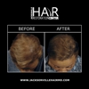 Jacksonville Hair Restoration Center gallery