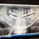 Blacks Fork Dental - Implant Dentistry