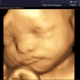 Heavenly 3d 4d Ultrasounds