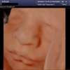 Heavenly 3D 4D Ultrasounds-Apple Valley gallery