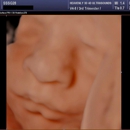 Heavenly 3D 4D Ultrasounds-Apple Valley - Medical Imaging Services