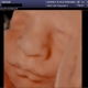 Heavenly 3D 4D Ultrasounds-Apple Valley