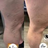 Vein Treatment Center gallery