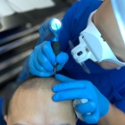 Scalp Micro Pro Clinic