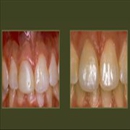 Walker Square Dental Assoc - Implant Dentistry