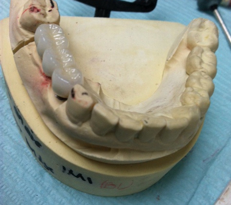 Precision Dental Ceramics Laboratory - Houston, TX