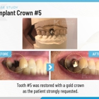 K Family Dentistry General Cosmetic Emergency Implants