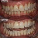 Orinda Family Dentistry - Dental Hygienists