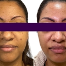 Reign Medical Aesthetics & Wellness - Villages - Day Spas