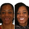 Britely Dentures + Implants Studio gallery
