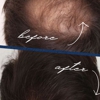 The Hair Loss Doctors By Robert J. Dorin gallery