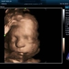 Baby Bee 3D Ultrasound (Fort Worth) gallery