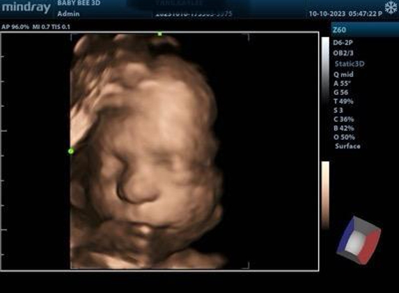 Baby Bee 3D Ultrasound (Fort Worth) - North Richland Hills, TX