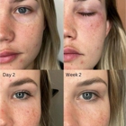 Restoration Medical Aesthetics