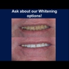 Decatur Smiles gallery