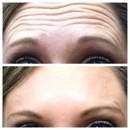 Lavers Center for Advanced Aesthetics - Medical Clinics