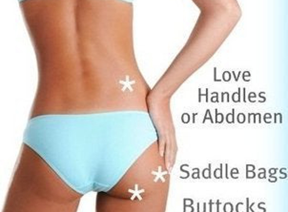 Secret Body Coolsculpting Las Vegas Clinic - Henderson, NV